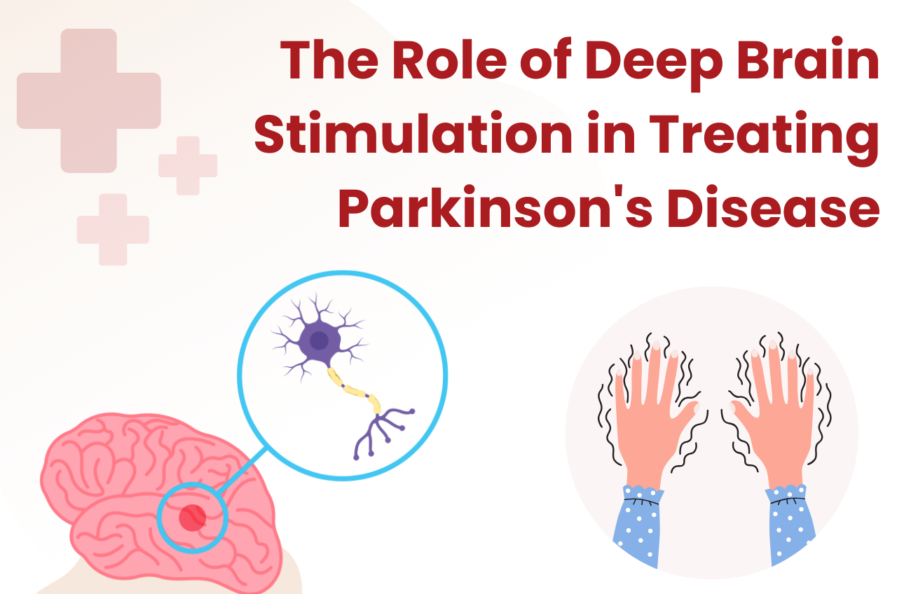 The Role of Deep Brain Stimulation in Treating Parkinson's Disease